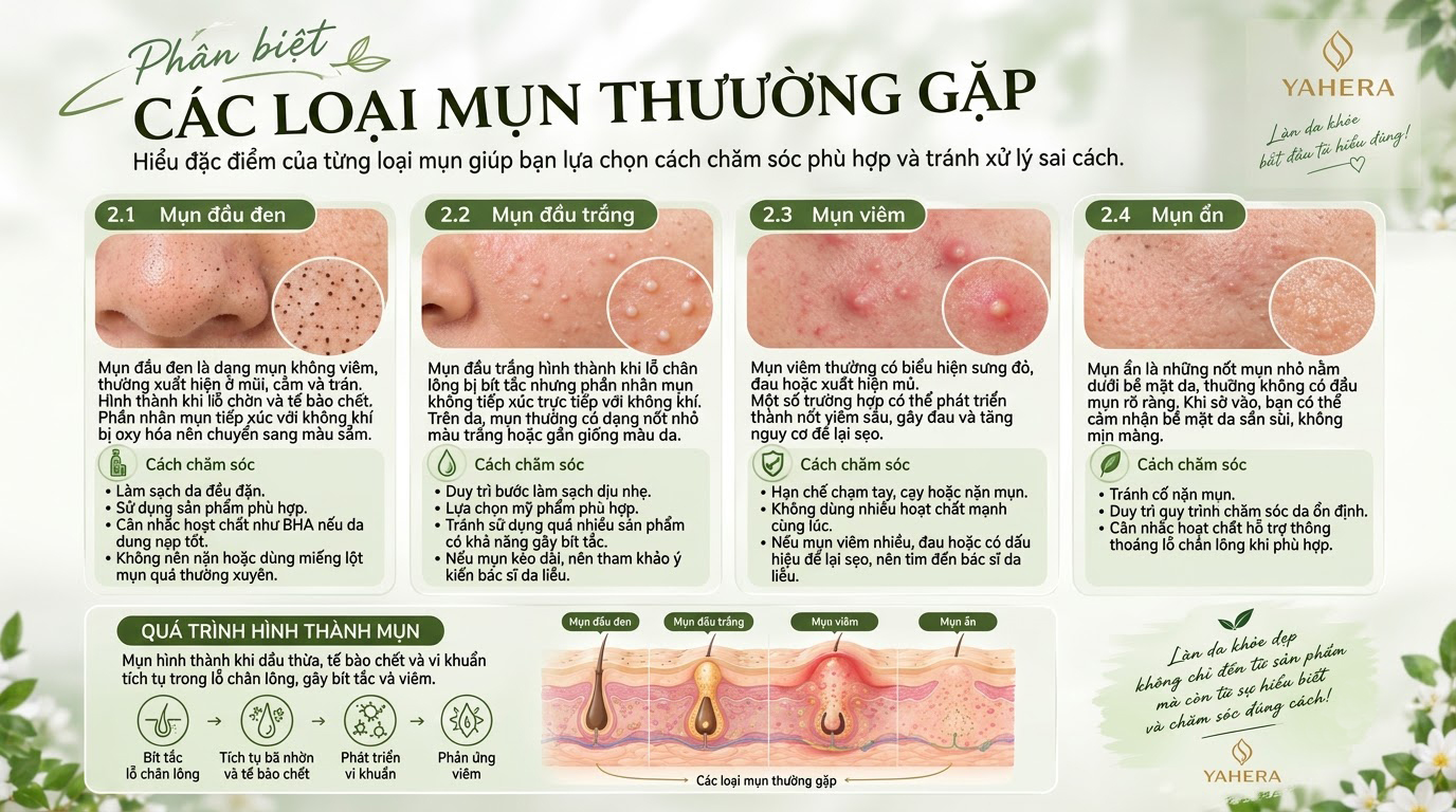 Da mụn là gì? Nguyên nhân gây mụn và cách chăm sóc da đúng cách cùng YAHERA 2 Phan-biet-cac-loai-mun-thuong-gap-2.jpg